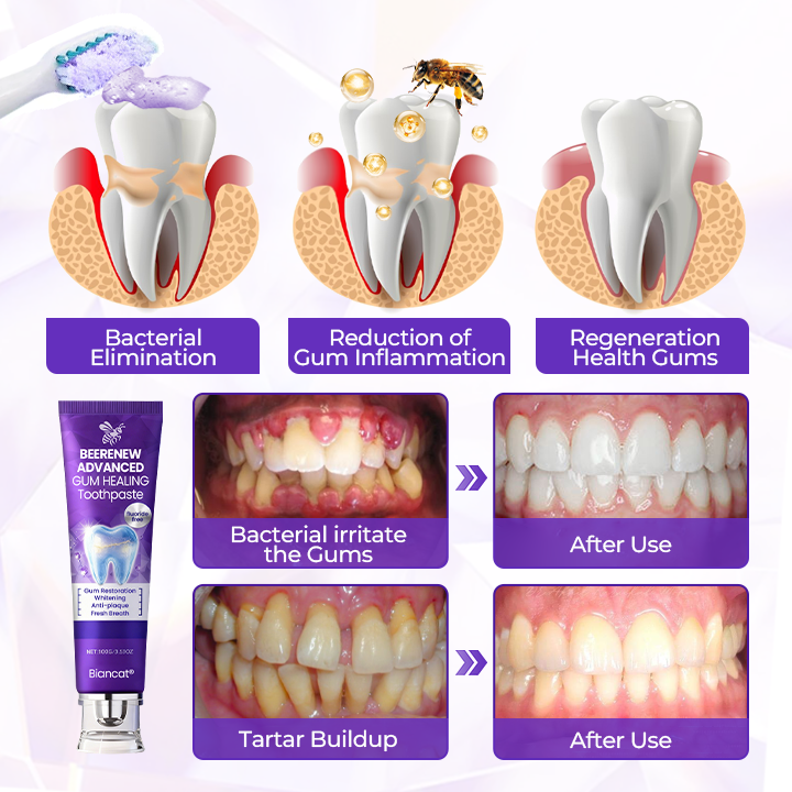 Biancat® BeeRenew Advanced Gum Healing Toothpaste🌟