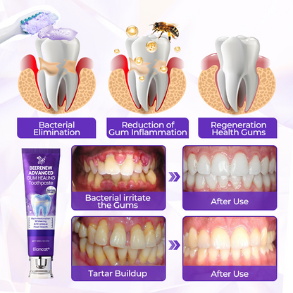 Biancat® BeeRenew Advanced Gum Healing Toothpaste🌟