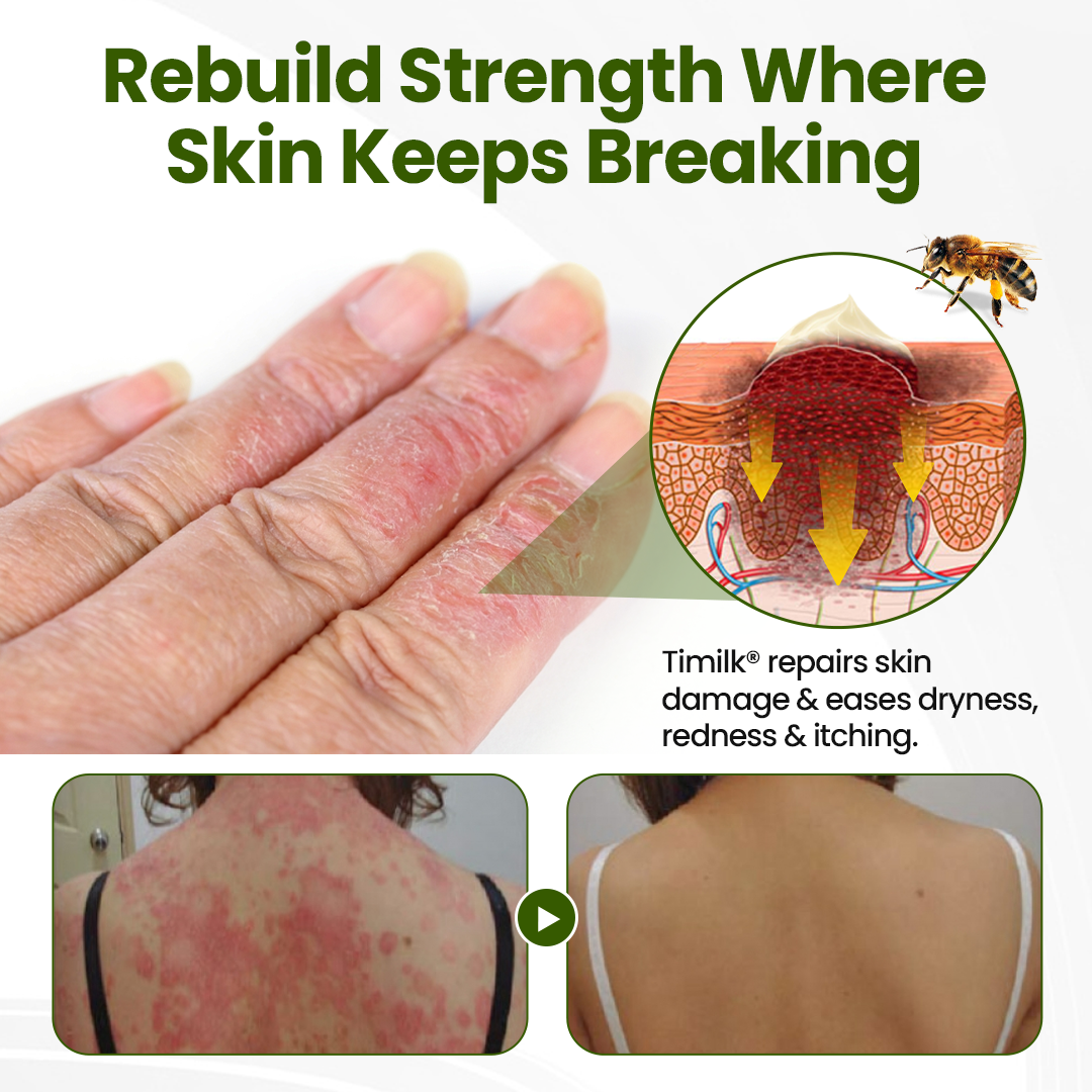 Timilk® BeePeptide RootSoft DualRelief Cream🌟