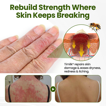Timilk® BeePeptide RootSoft DualRelief Cream🌟