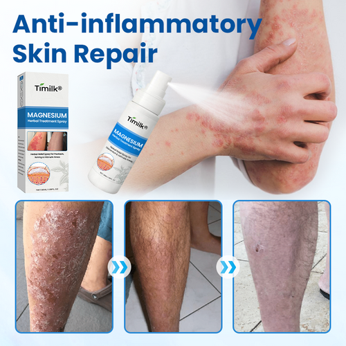 Timilk® PCA Magnesium Deep Repair Spray🌟