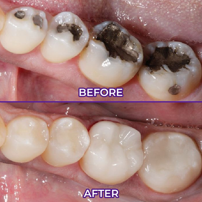 Ceoerty® VioletX Advanced Whitening Complex
