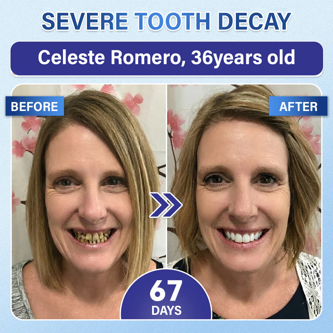 Ceoerty® Tooth & Gum Repair Fast-Dissolving Microneedle Patch✨ (𝟓-𝐢𝐧-𝟏 💎 𝐑𝐞𝐛𝐮𝐢𝐥𝐝 𝐄𝐧𝐚𝐦𝐞𝐥 & 𝐃𝐞𝐧𝐭𝐢𝐧 • 𝐒𝐭𝐫𝐞𝐧𝐠𝐭𝐡𝐞𝐧 𝐆𝐮𝐦𝐬 • 𝐄𝐫𝐚𝐝𝐢𝐜𝐚𝐭𝐞 𝐓𝐚𝐫𝐭𝐚𝐫 & 𝐎𝐝𝐨𝐫 • 𝐖𝐡𝐢𝐭𝐞𝐧𝐢𝐧𝐠 • 𝐒𝐭𝐨𝐩 𝐓𝐨𝐨𝐭𝐡 𝐒𝐞𝐧𝐬𝐢𝐭𝐢𝐯𝐢𝐭𝐲)
