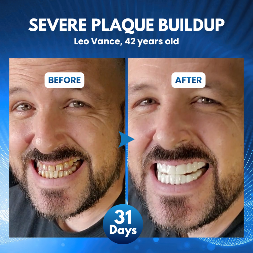 Biancat® ProDenti Tideglusib Tooth and Gum Repair Oral Strips
