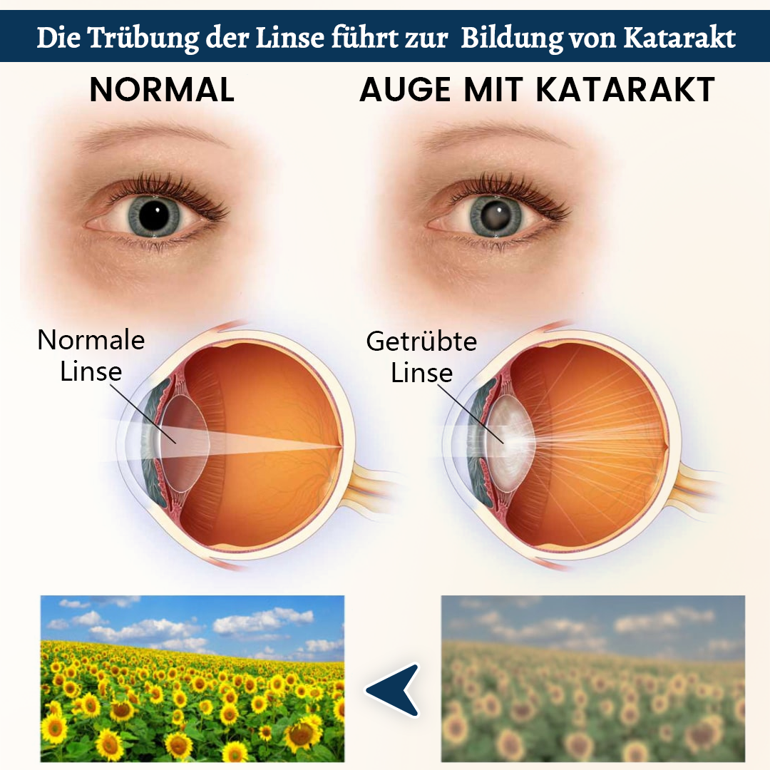 Ceoerty® OptiFusion Vision Support Augenpflaster