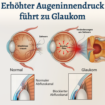 Ceoerty® OptiFusion Vision Support Augenpflaster