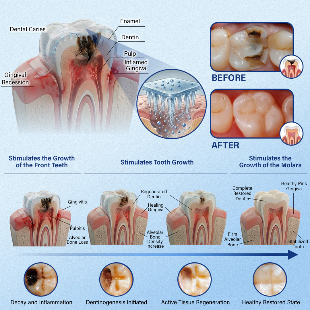 Ceoerty® Tooth & Gum Repair Fast-Dissolving Microneedle Patch✨ (𝟓-𝐢𝐧-𝟏 💎 𝐑𝐞𝐛𝐮𝐢𝐥𝐝 𝐄𝐧𝐚𝐦𝐞𝐥 & 𝐃𝐞𝐧𝐭𝐢𝐧 • 𝐒𝐭𝐫𝐞𝐧𝐠𝐭𝐡𝐞𝐧 𝐆𝐮𝐦𝐬 • 𝐄𝐫𝐚𝐝𝐢𝐜𝐚𝐭𝐞 𝐓𝐚𝐫𝐭𝐚𝐫 & 𝐎𝐝𝐨𝐫 • 𝐖𝐡𝐢𝐭𝐞𝐧𝐢𝐧𝐠 • 𝐒𝐭𝐨𝐩 𝐓𝐨𝐨𝐭𝐡 𝐒𝐞𝐧𝐬𝐢𝐭𝐢𝐯𝐢𝐭𝐲)