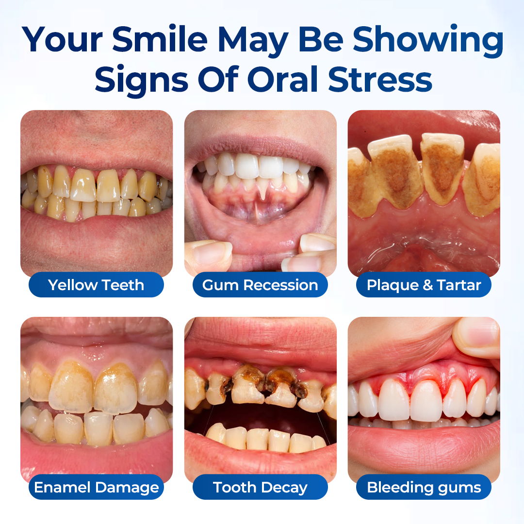 Mresio® RegenDent Advanced Tooth & Gum Renewal Device
