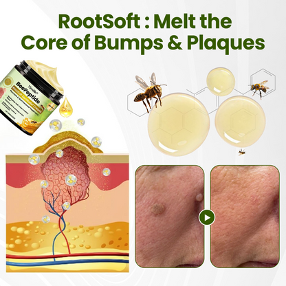 Timilk® BeePeptide RootSoft DualRelief Cream🌟