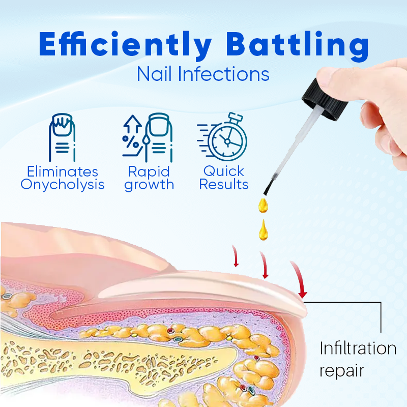 Biancat®  OnyxoGuard Nail Growth and Repair 🌟