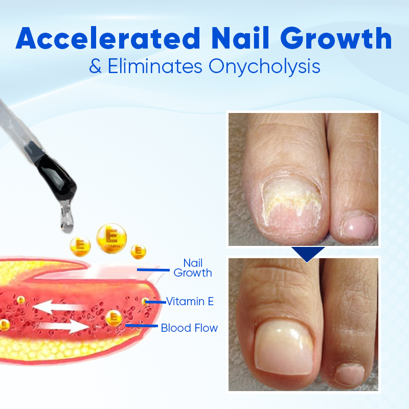 Biancat®  OnyxoGuard Nail Growth and Repair 🌟