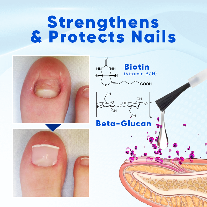 Biancat®  OnyxoGuard Nail Growth and Repair 🌟